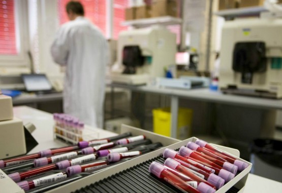 AMA suspende acreditación de laboratorio antidopaje de Bogotá