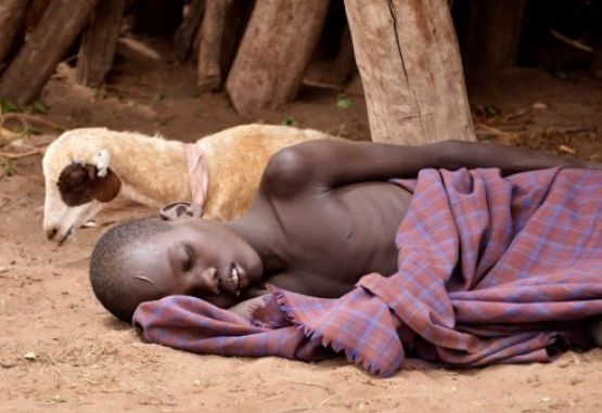 Niño africano con Malaria