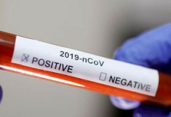 Prueba rapida coronavirus web